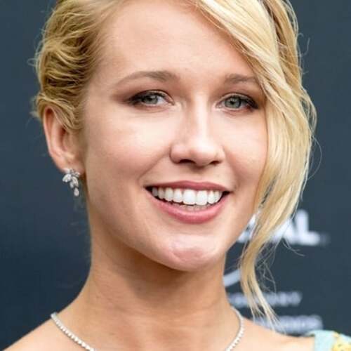 Anna Camp